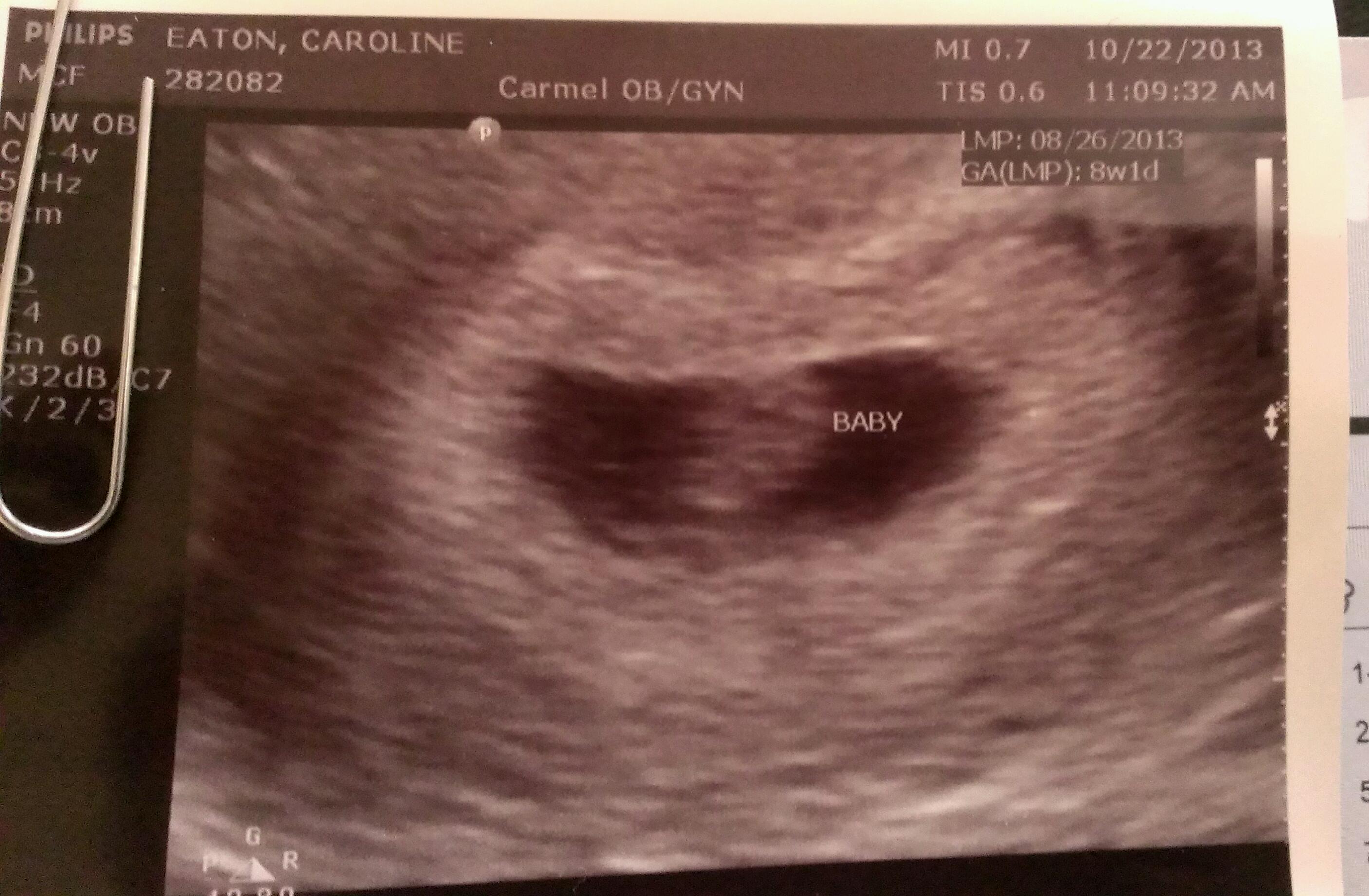 My Baby Blob